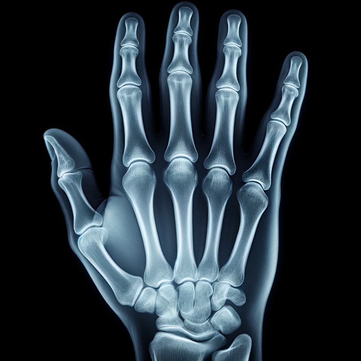 Artrosis vs Artritis: Desentrañando las diferencias entre dos enfermedades comunes de las articulaciones